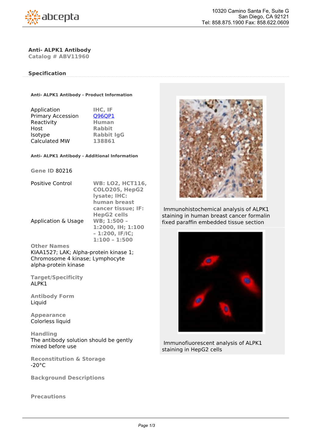 Anti- ALPK1 Antibody Catalog # ABV11960