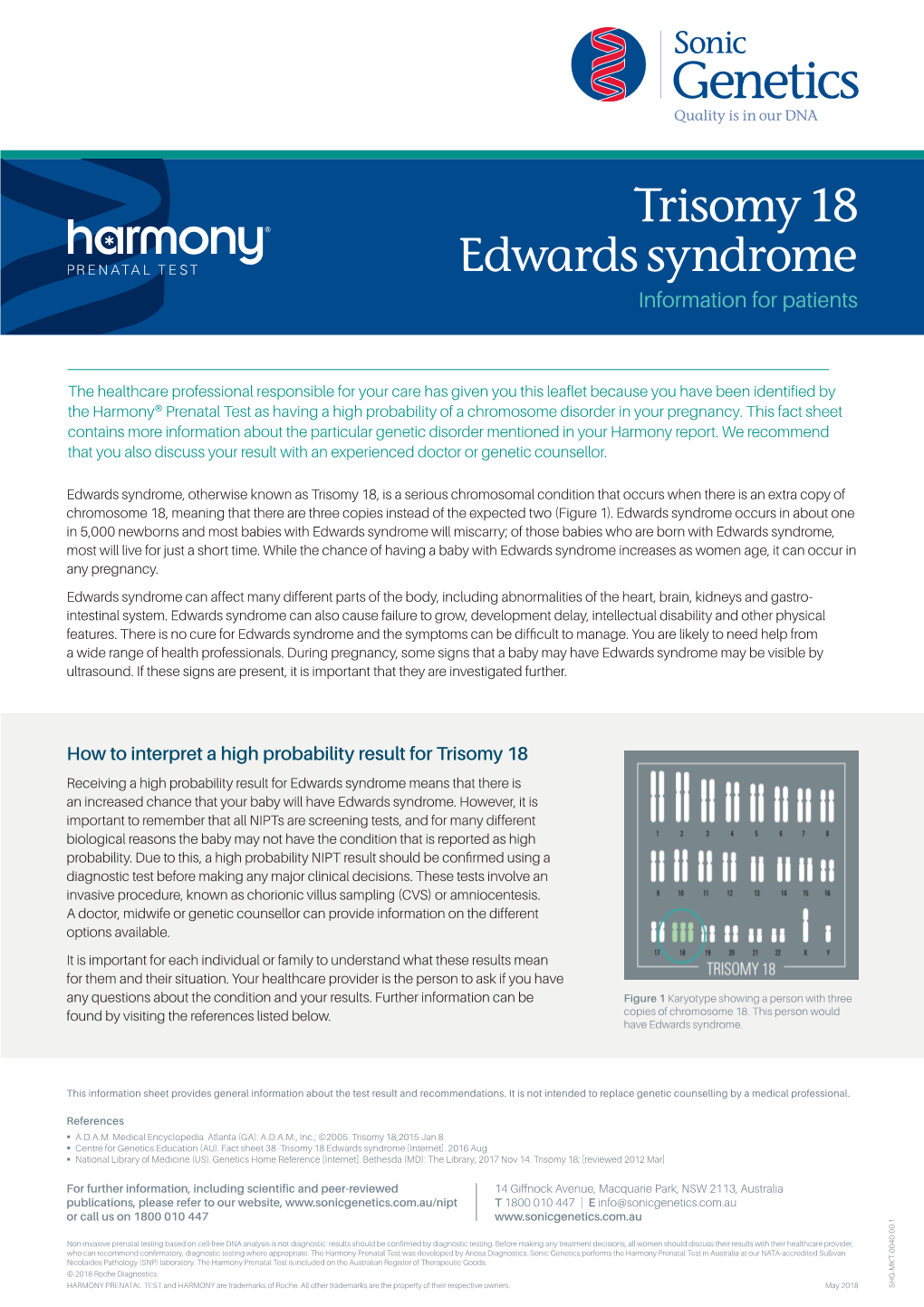 Trisomy 18 Edwards Syndrome Information for Patients
