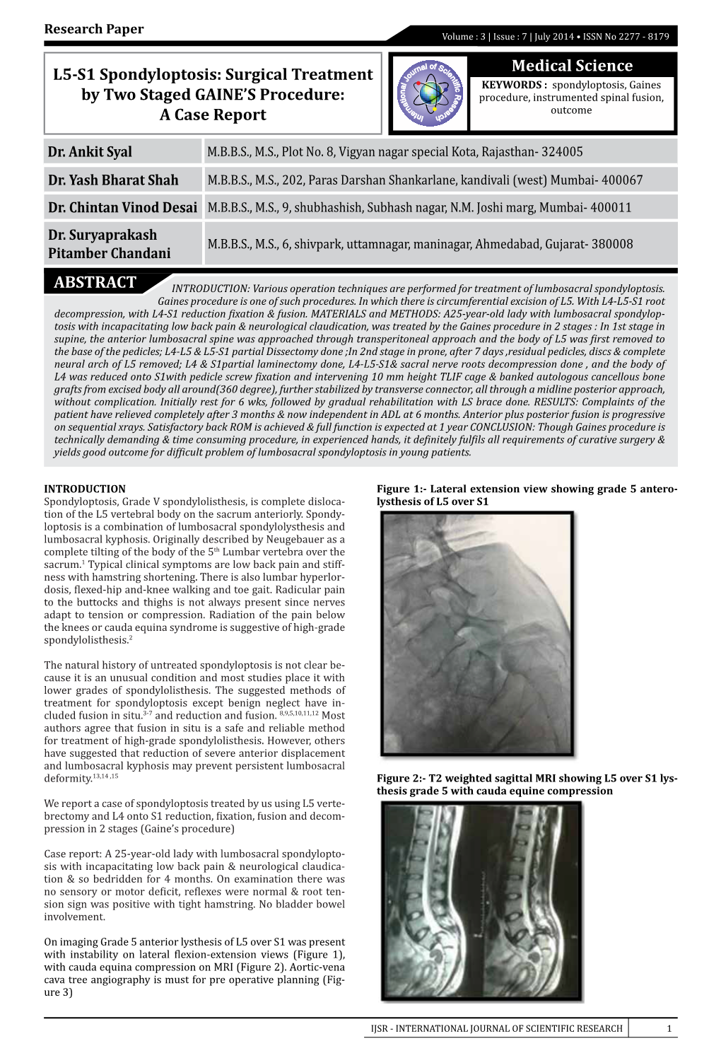 Medical Science ABSTRACT L5-S1 Spondyloptosis: Surgical Treatment by Two Staged GAINE's Procedure: a Case Report