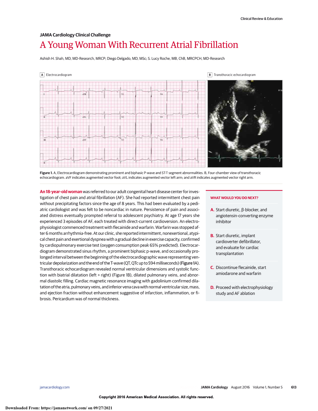 A Young Woman with Recurrent Atrial Fibrillation