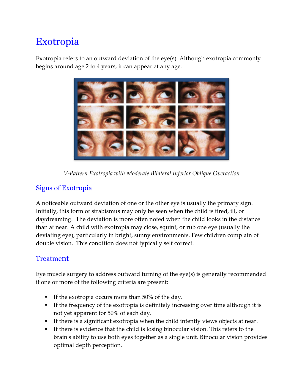 Exotropia (Outward Turning of Eye(S))