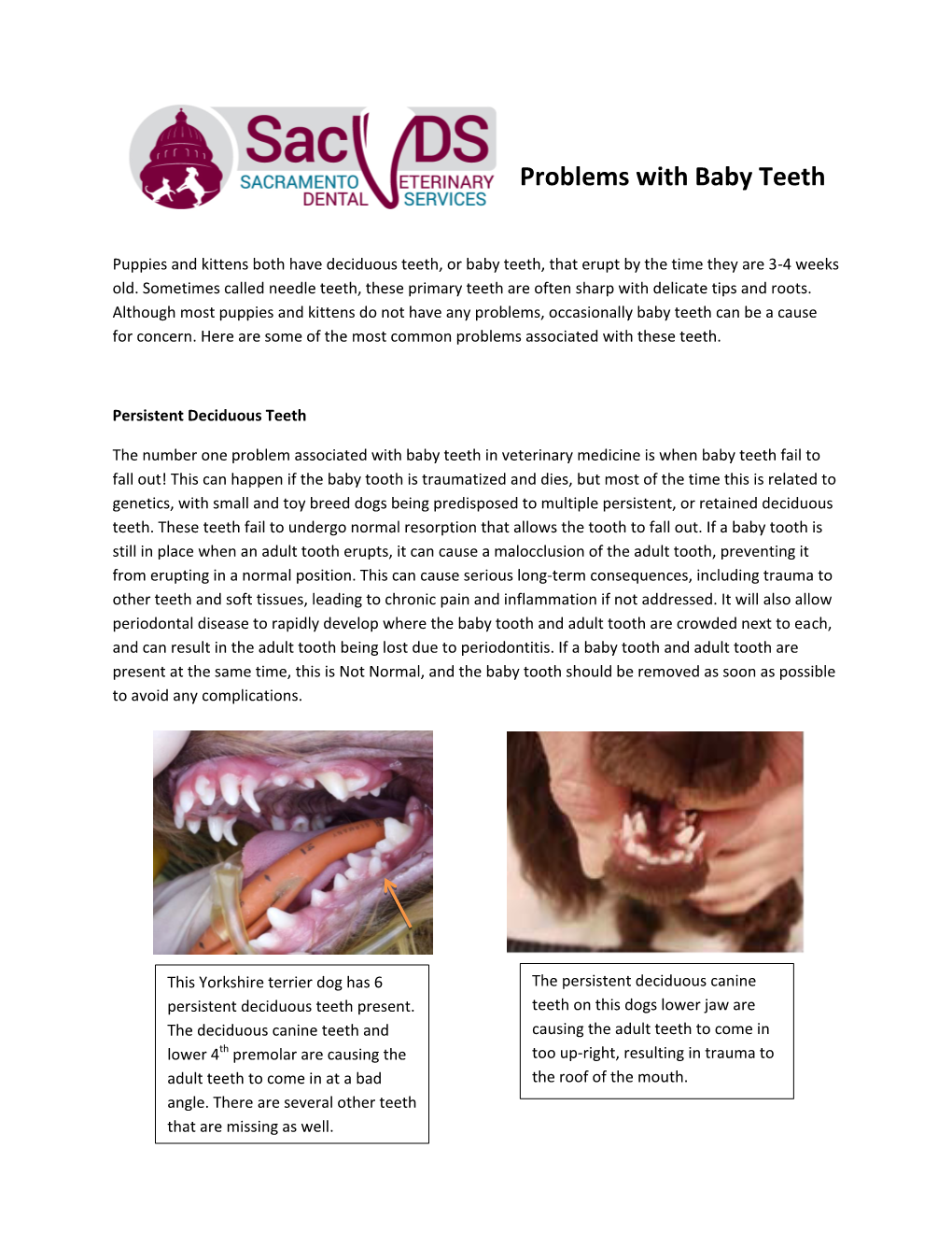 Problems with Baby Teeth