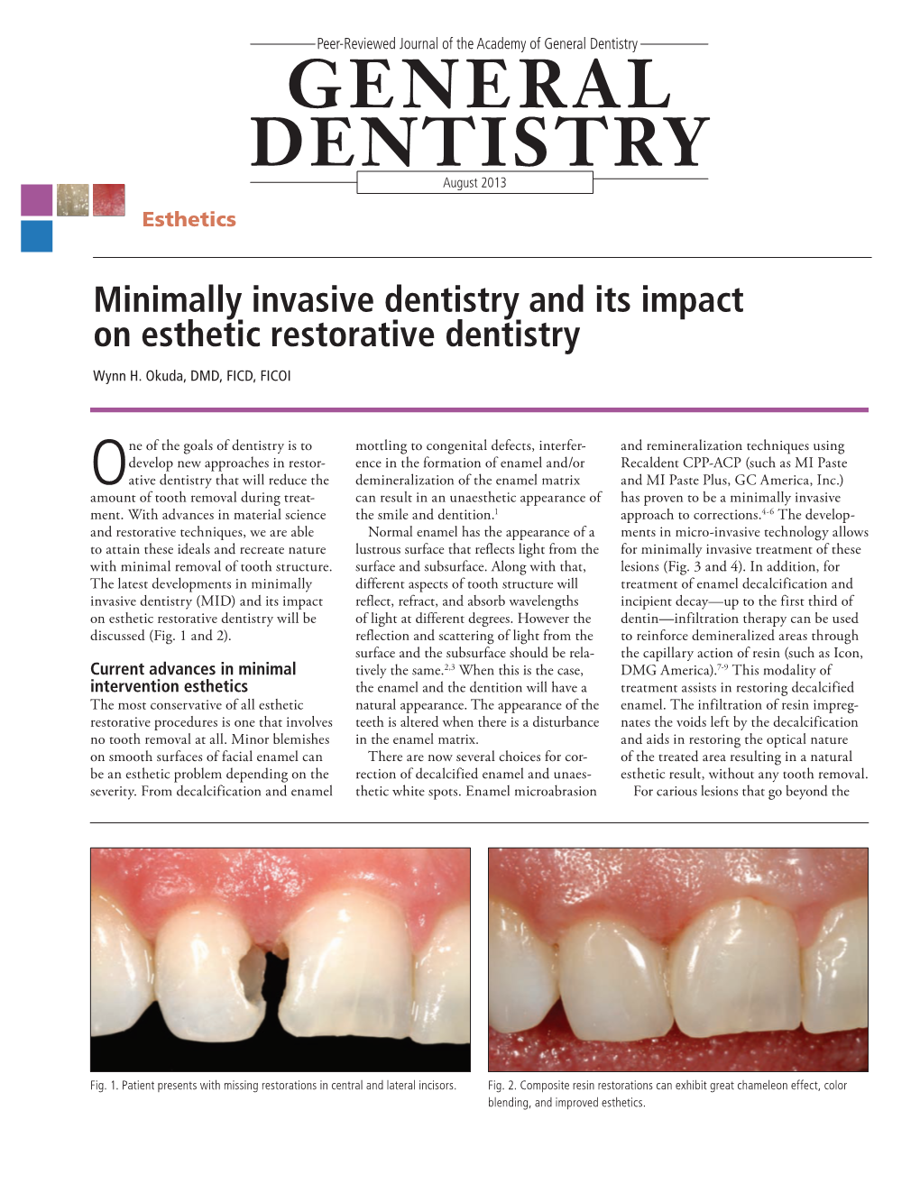 Minimally Invasive Dentistry and Its Impact on Esthetic Restorative Dentistry Wynn H
