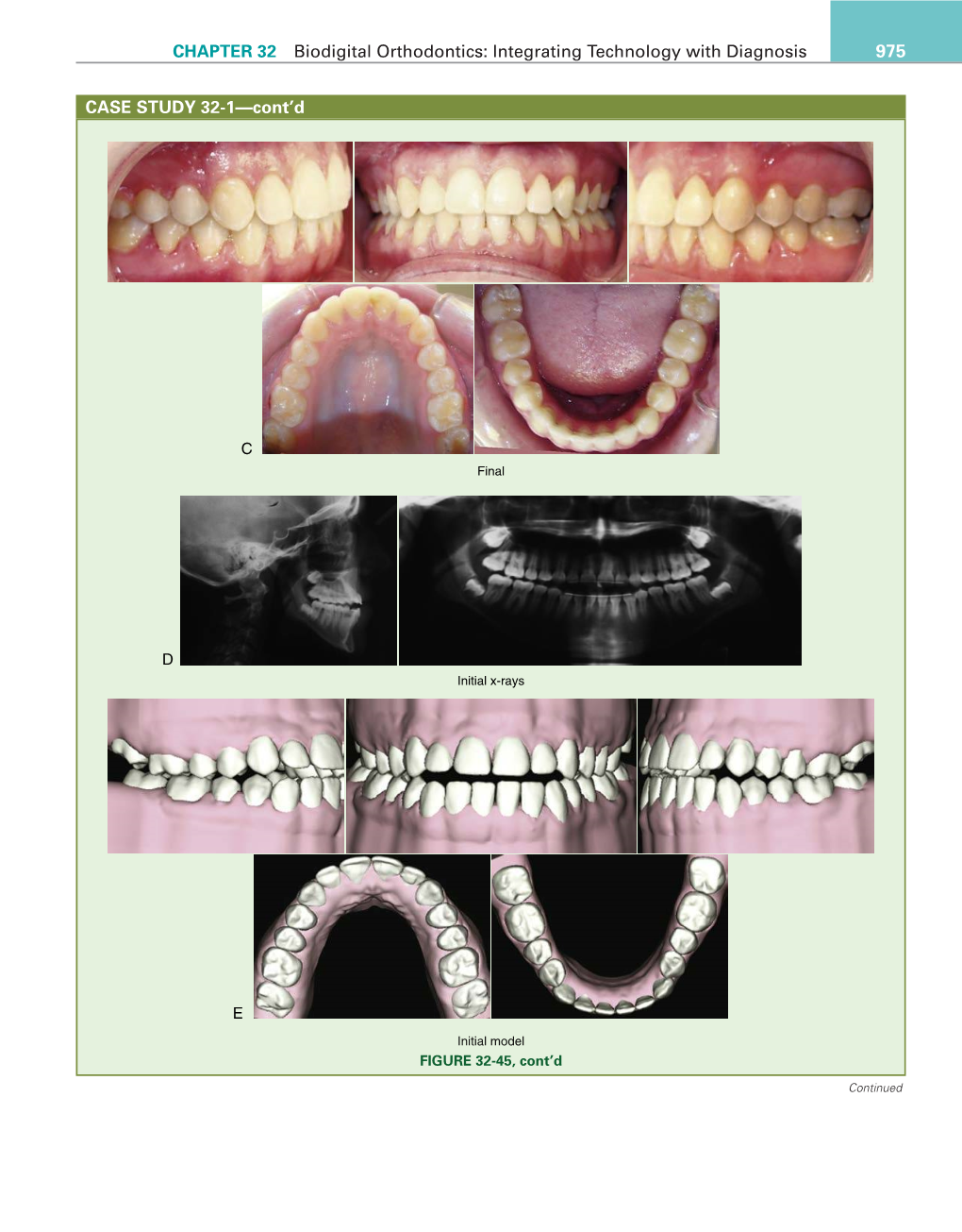 CHAPTER 32 Biodigital Orthodontics: Integrating Technology with Diagnosis 975