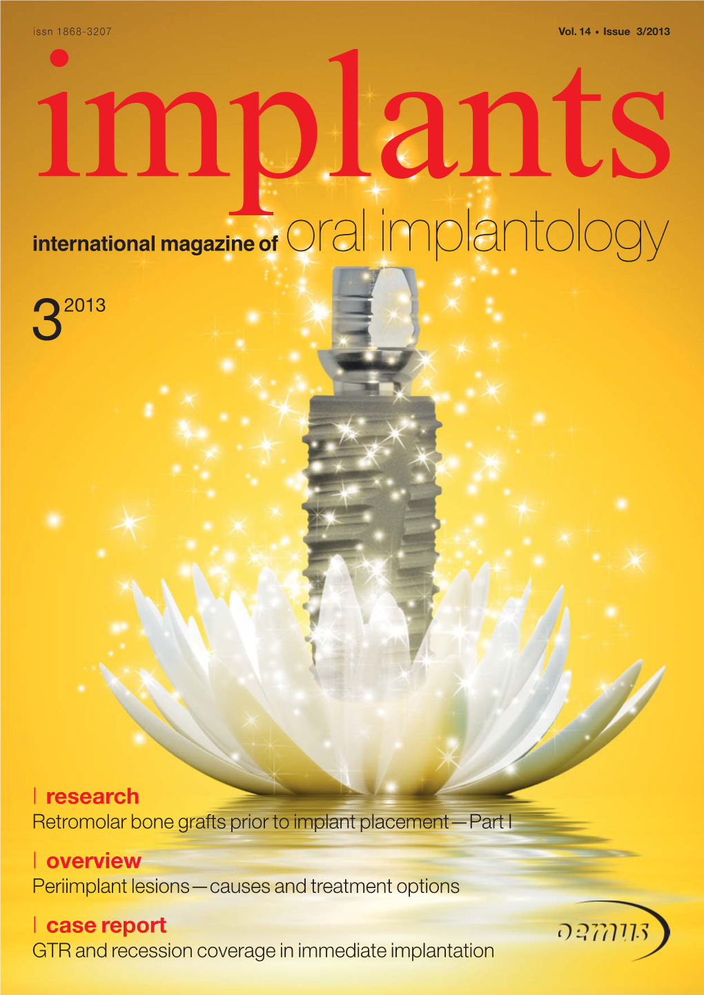 Case Report GTR and Recession Coverage in Immediate Implantation DENTSPLY Implants – the New 79571-USX-1212 © 2012 DENTSPLY IH Powerhouse in Implant Dentistry