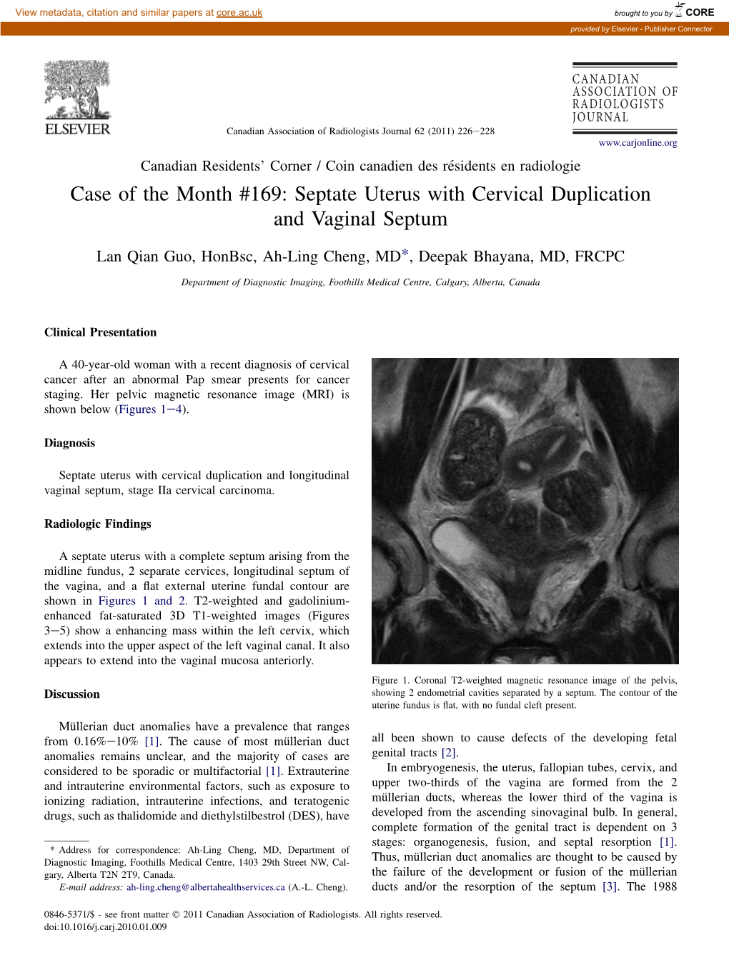 Septate Uterus with Cervical Duplication and Vaginal Septum