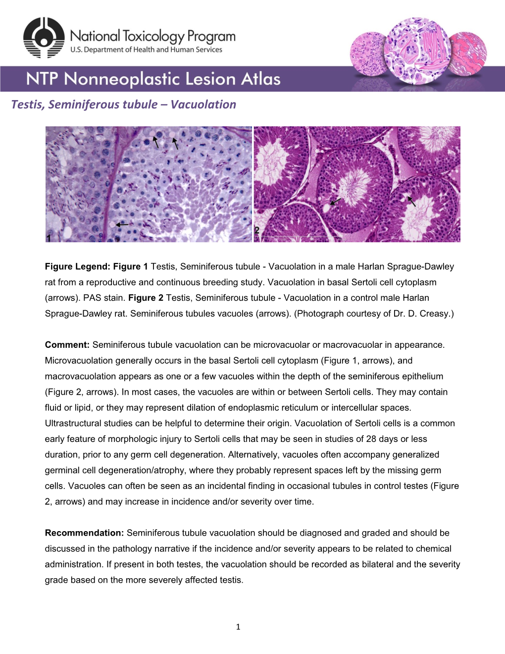 Testis, Seminiferous Tubule – Vacuolation