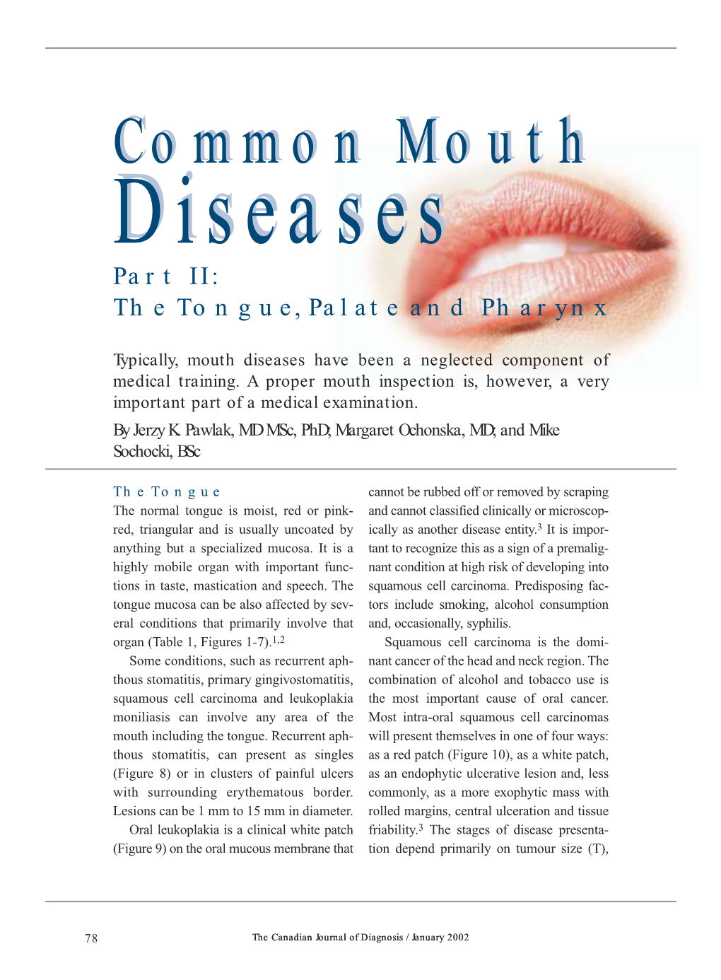 Common Mouth Diseases
