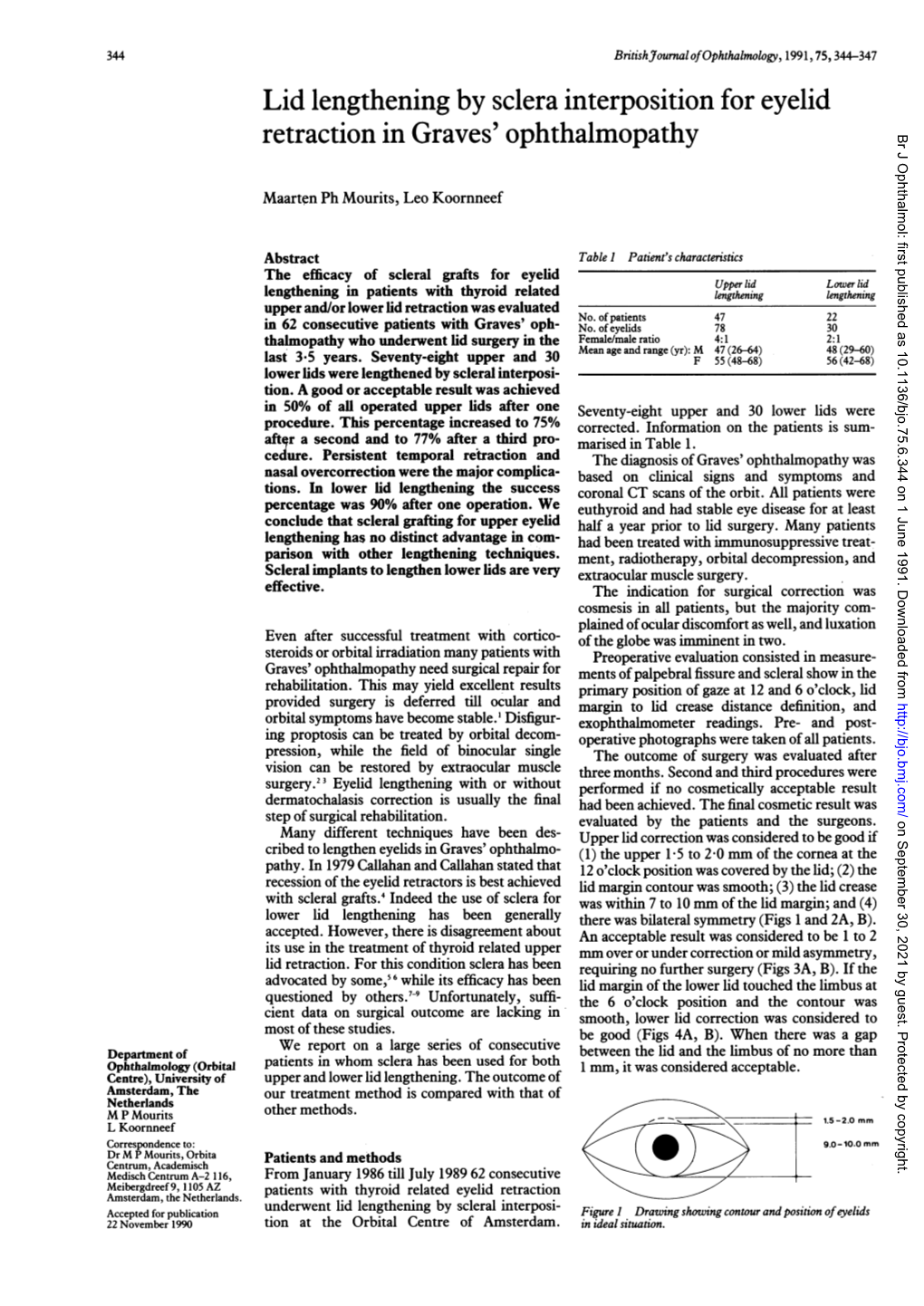 Lid Lengthening by Sclera Interposition for Eyelid Retraction in Graves