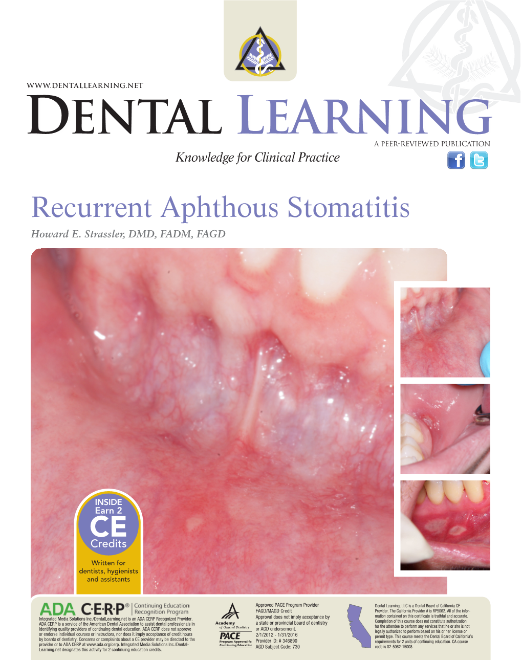 Recurrent Aphthous Stomatitis Howard E