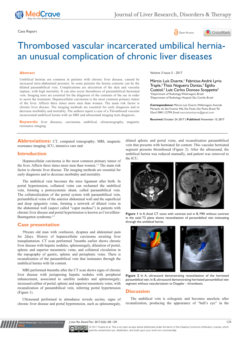 Thrombosed Vascular Incarcerated Umbilical Hernia-An Unusual Complication of Chronic Liver Diseases ©2017 Duarte Et Al