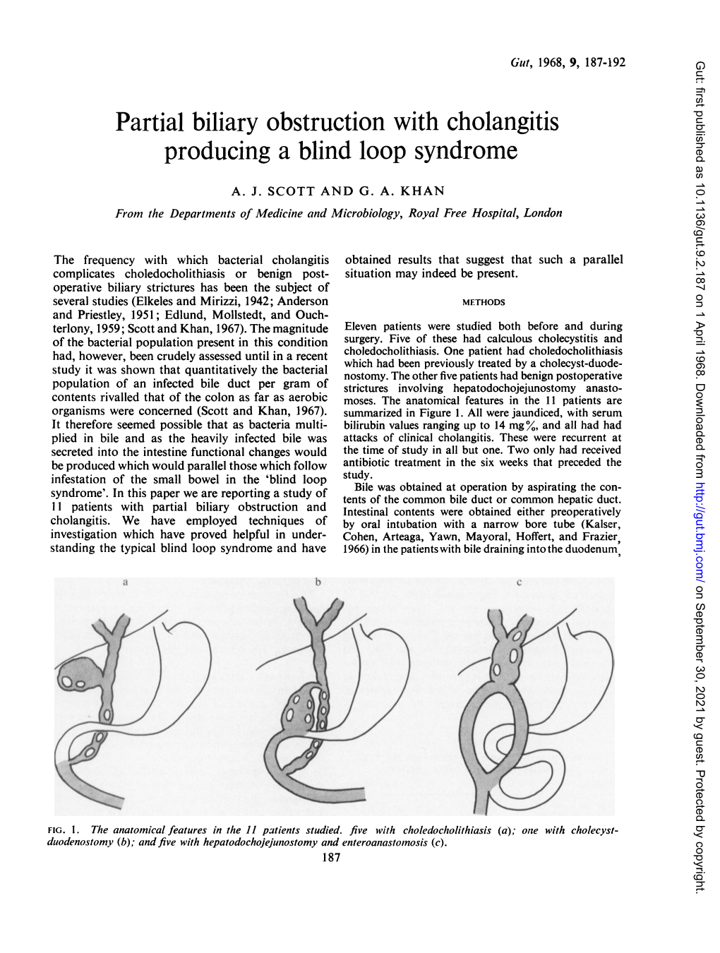 Partial Biliary Obstruction with Cholangitis Producing a Blind Loop Syndrome