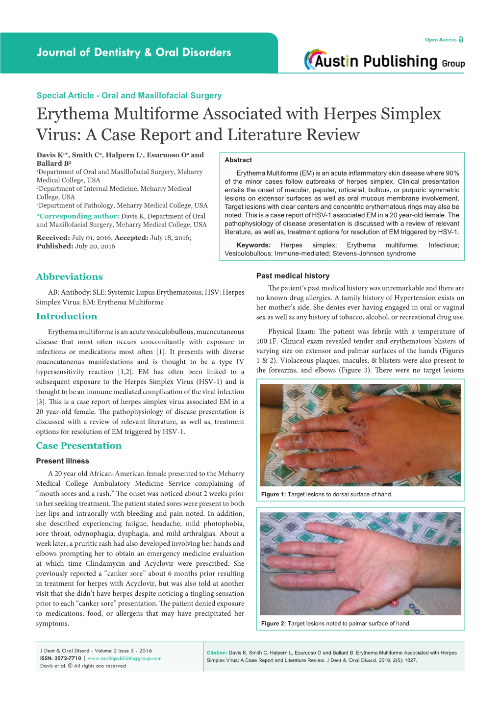 Erythema Multiforme Associated with Herpes Simplex Virus: a Case Report and Literature Review