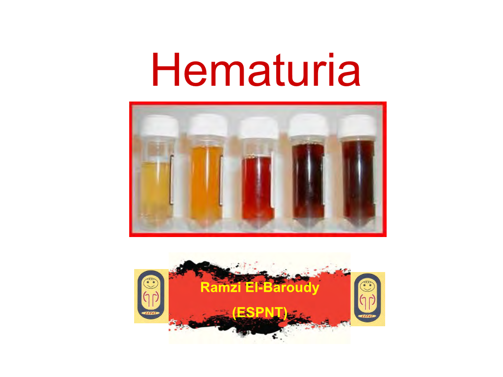 Hematuria Is the Presence of Rbcs in Urine. If the Amount of Blood in Urine Is Big Enough, the Urine Will, Then, Look Red