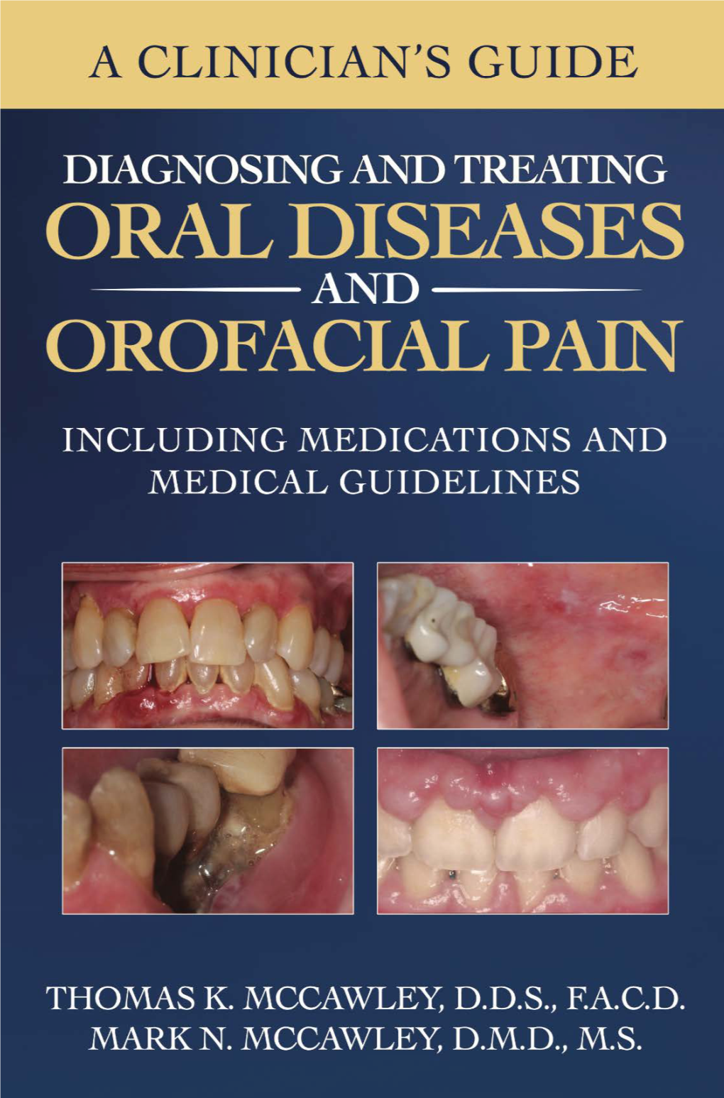 Angular Cheilitis