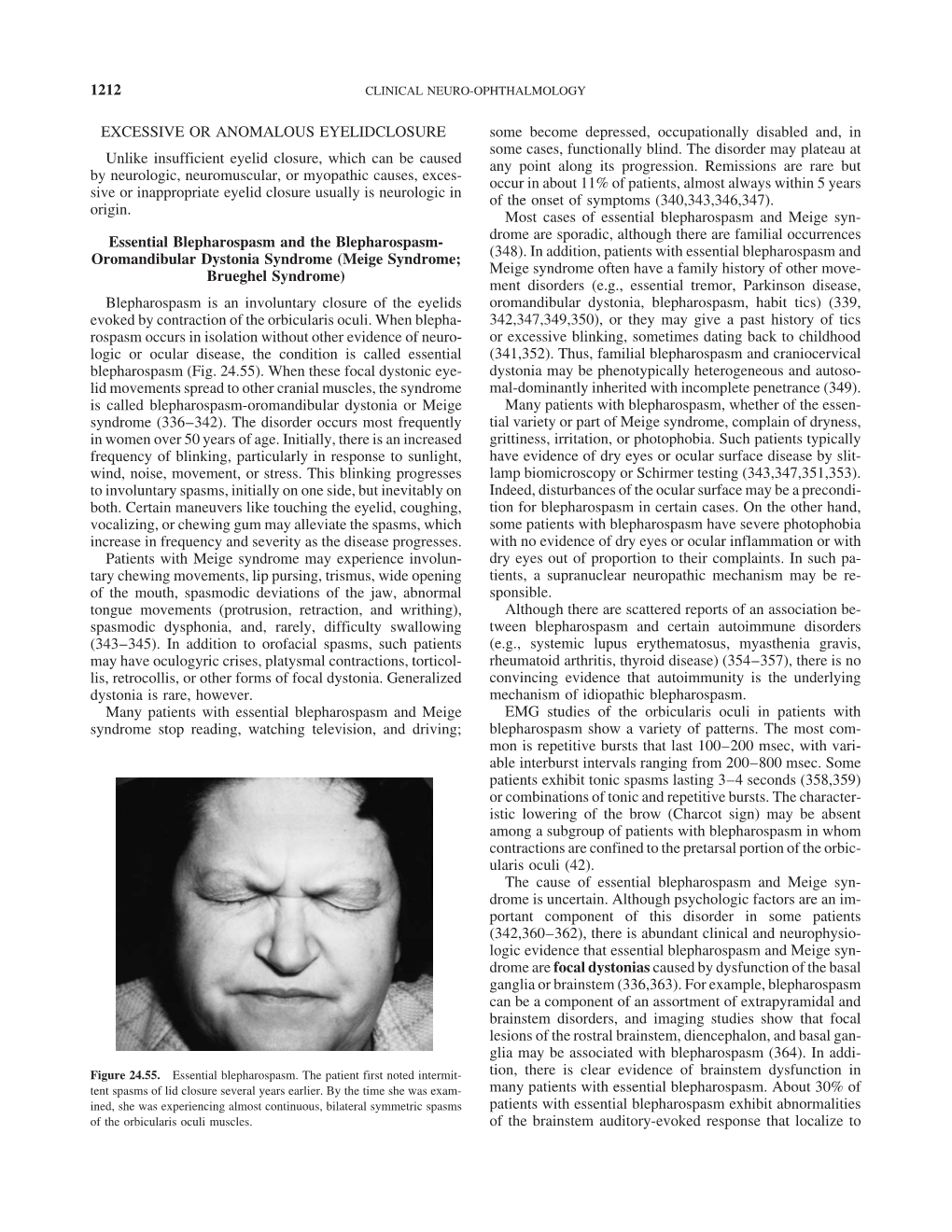 1212 EXCESSIVE OR ANOMALOUS EYELID CLOSURE Unlike Insufficient Eyelid Closure, Which Can Be Caused by Neurologic, Neuromuscular