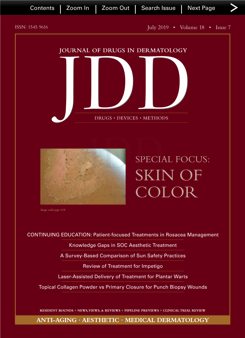 Journal of Drugs in Dermatology EDITOR-IN-CHIEF Perry Robins MD CO-EDITOR-IN-CHIEF Deborah S