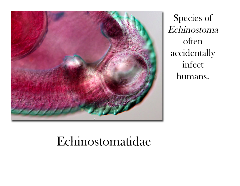 Echinostomatidae