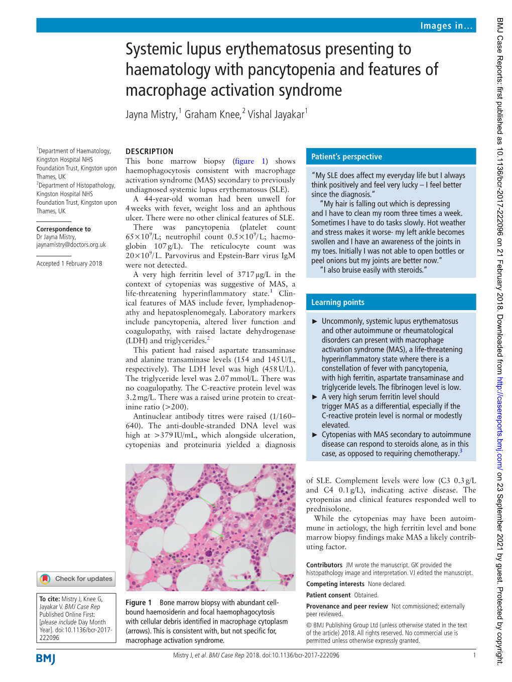 Systemic Lupus Erythematosus Presenting to Haematology with Pancytopenia and Features of Macrophage Activation Syndrome Jayna Mistry,1 Graham Knee,2 Vishal Jayakar1