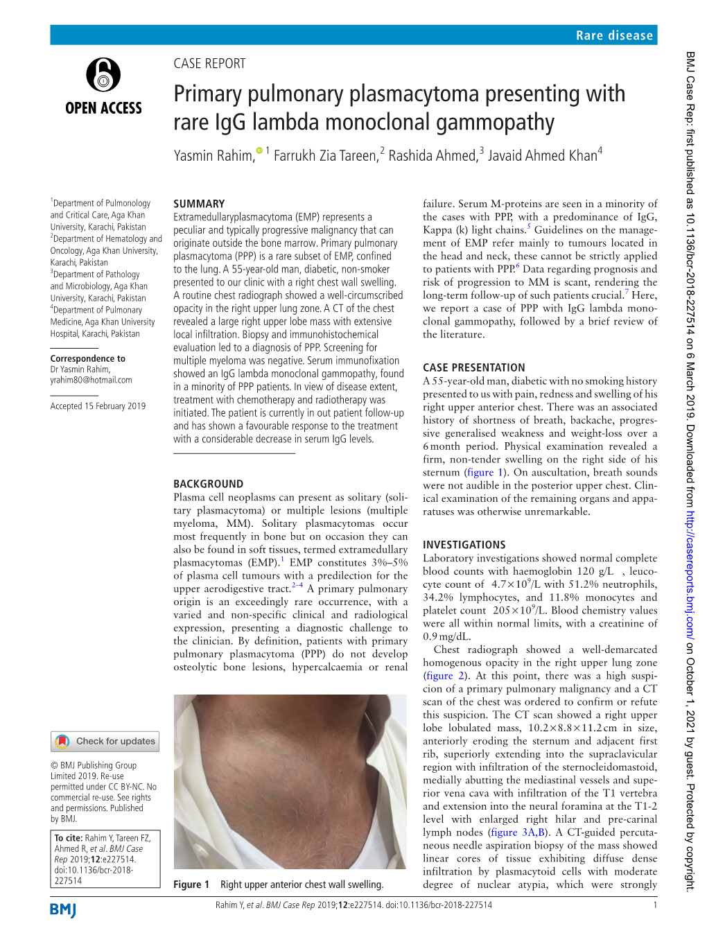 Primary Pulmonary Plasmacytoma Presenting with Rare Igg Lambda Monoclonal Gammopathy Yasmin Rahim, 1 Farrukh Zia Tareen,2 Rashida Ahmed,3 Javaid Ahmed Khan4