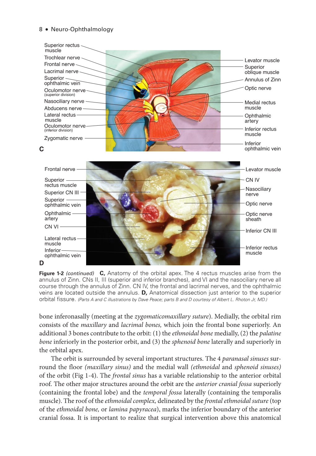 Bone Inferonasally (Meeting at the Zygomaticomaxillary Suture)