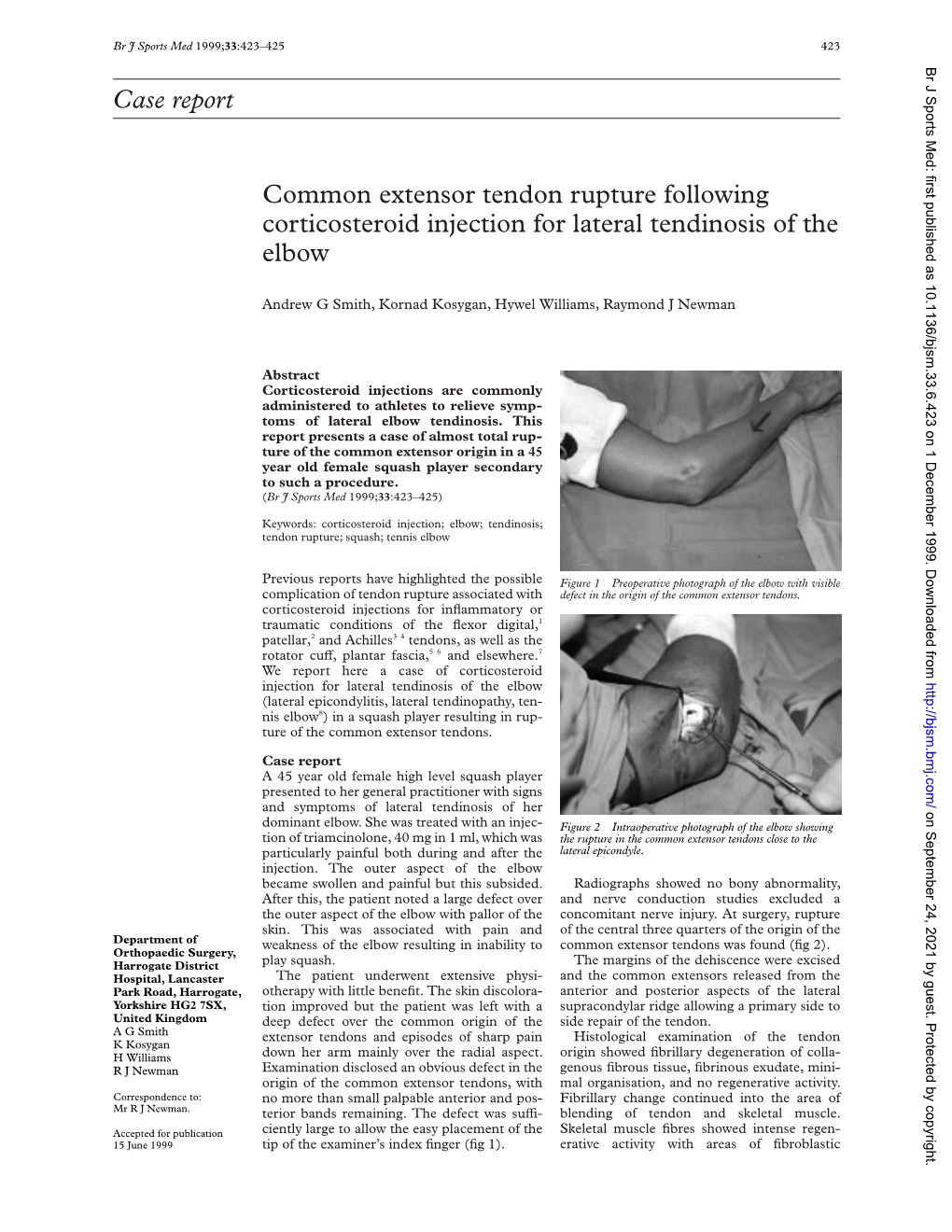 Case Report Common Extensor Tendon Rupture Following Corticosteroid