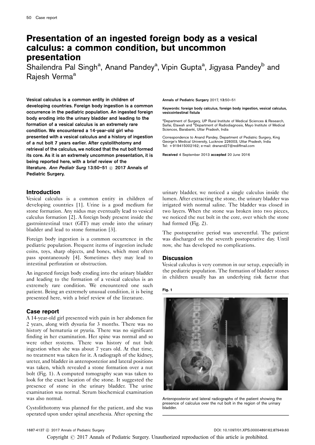 Presentation of an Ingested Foreign Body As a Vesical Calculus