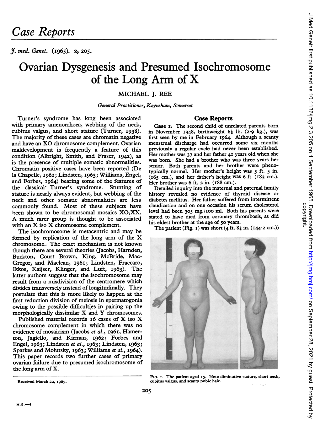 Ovarian Dysgenesis and Presumed Isochromosome of the Long Arm of X MICHAEL J