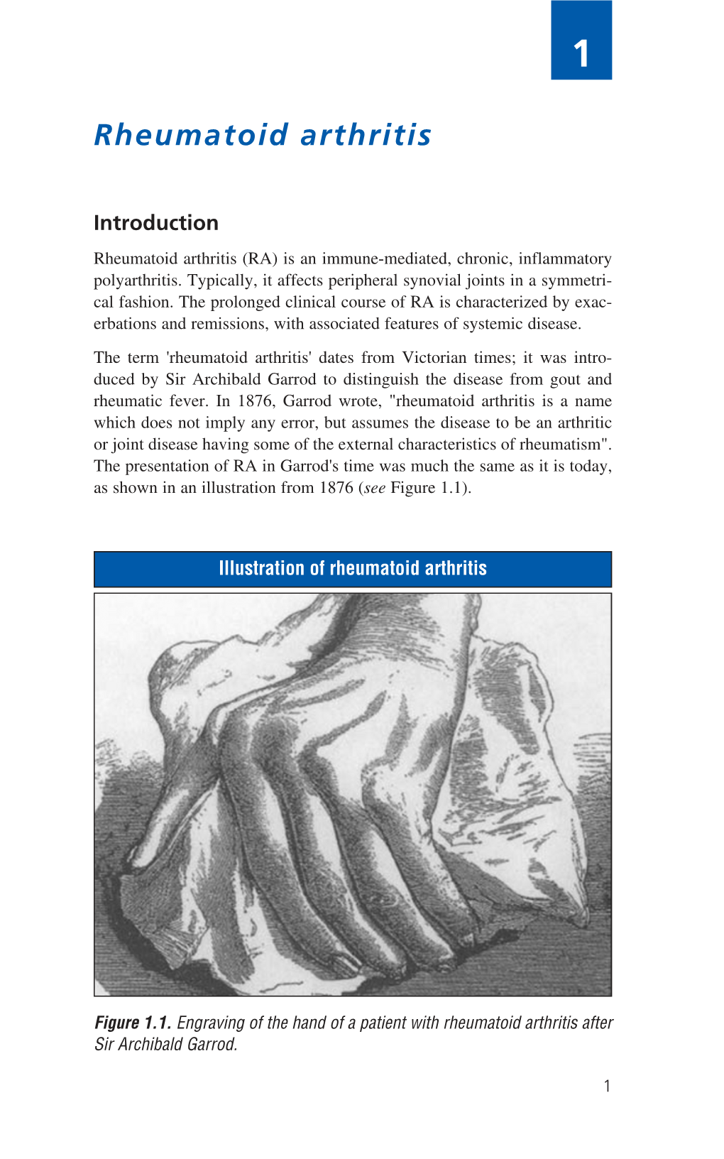 Rheumatoid Arthritis