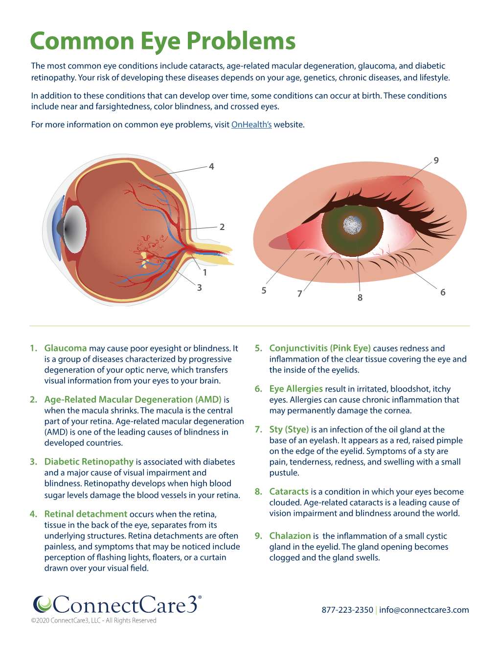 Common Eye Problems the Most Common Eye Conditions Include Cataracts, Age-Related Macular Degeneration, Glaucoma, and Diabetic Retinopathy