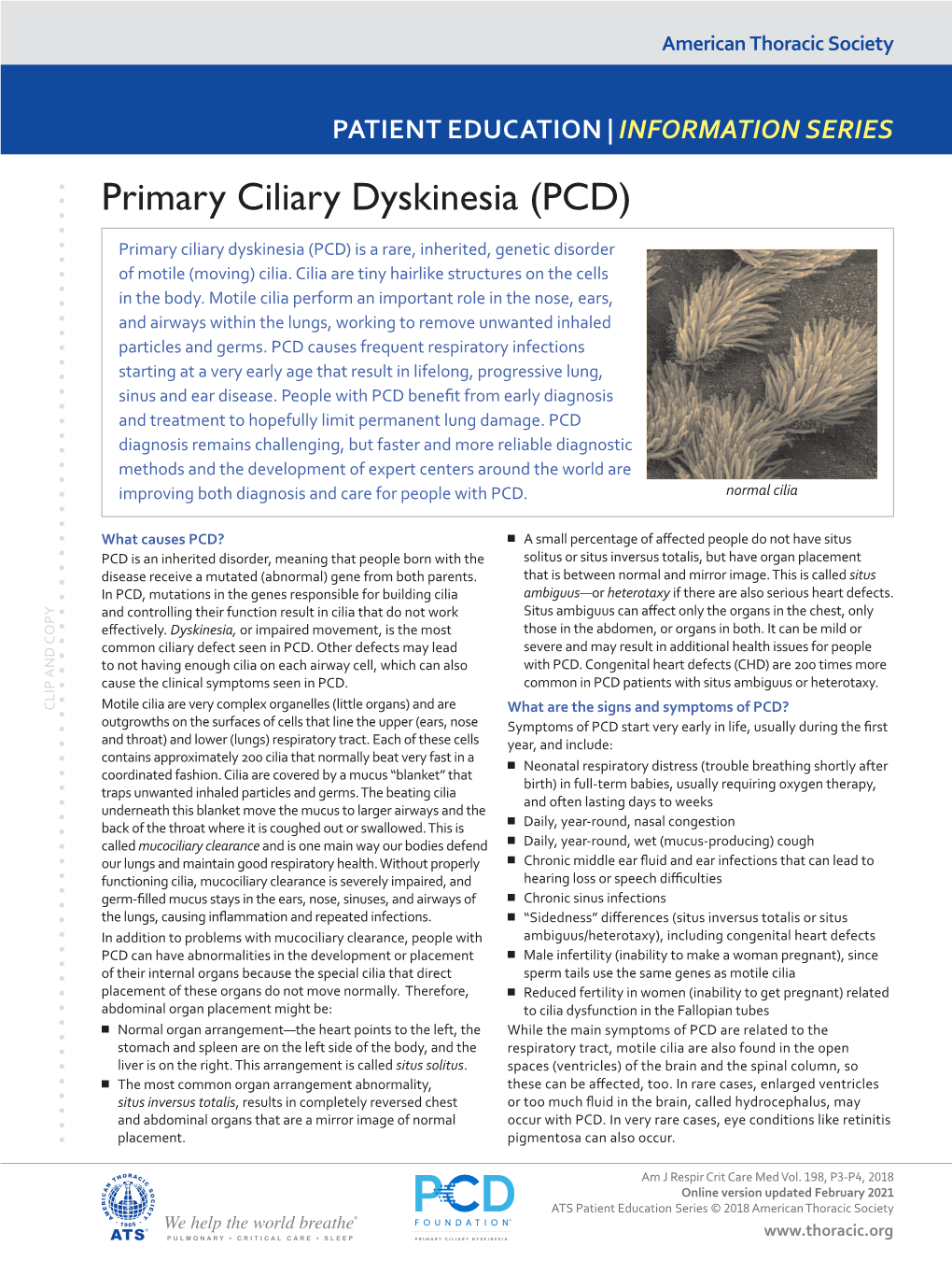 Primary Ciliary Dyskinesia (PCD)