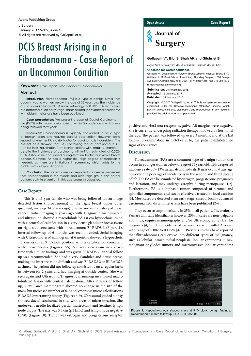 DCIS Breast Arising in a Fibroadenoma - Case Report of an Uncommon Condition