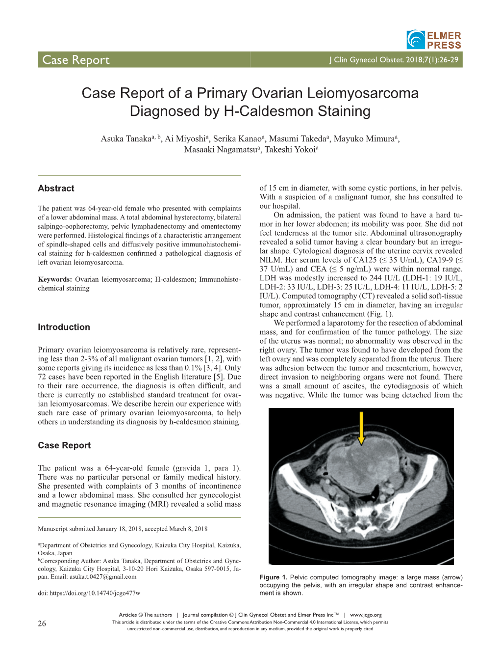 Case Report of a Primary Ovarian Leiomyosarcoma Diagnosed by H-Caldesmon Staining