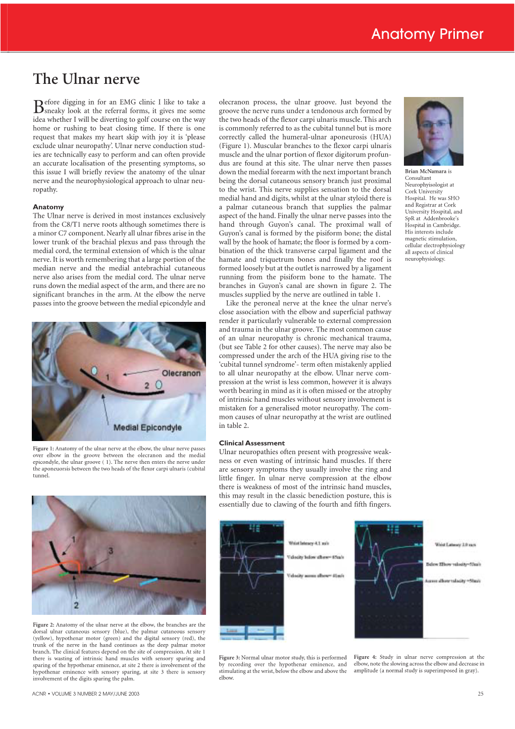 The Ulnar Nerve