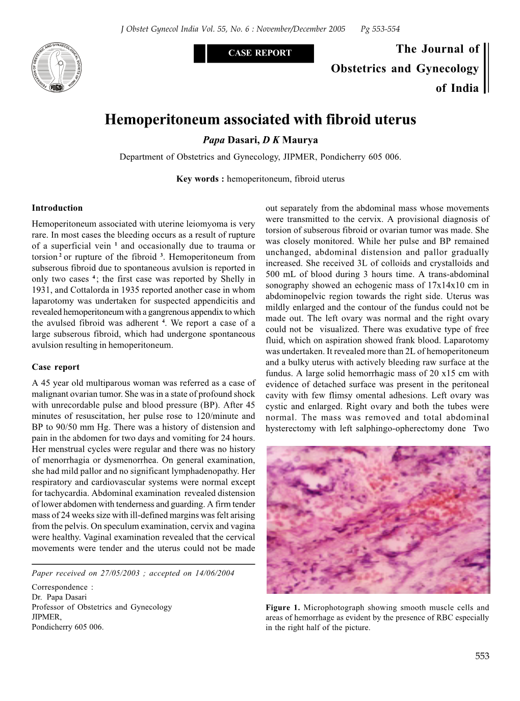 Hemoperitoneum Associated with Fibroid Uterus Papa Dasari, D K Maurya Department of Obstetrics and Gynecology, JIPMER, Pondicherry 605 006