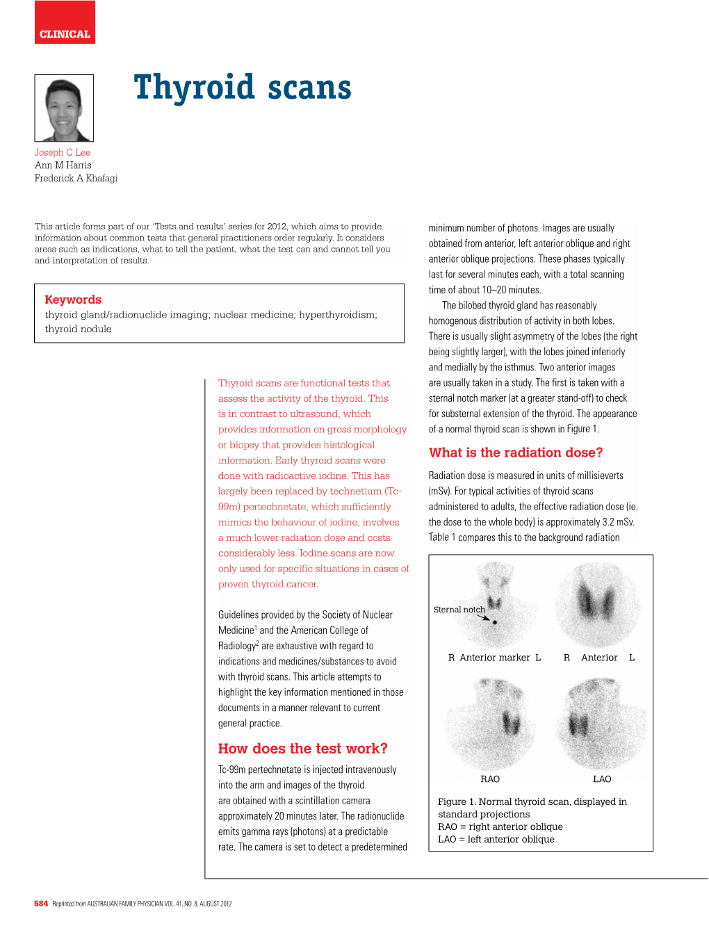 Thyroid Scans (Pdf 433KB)