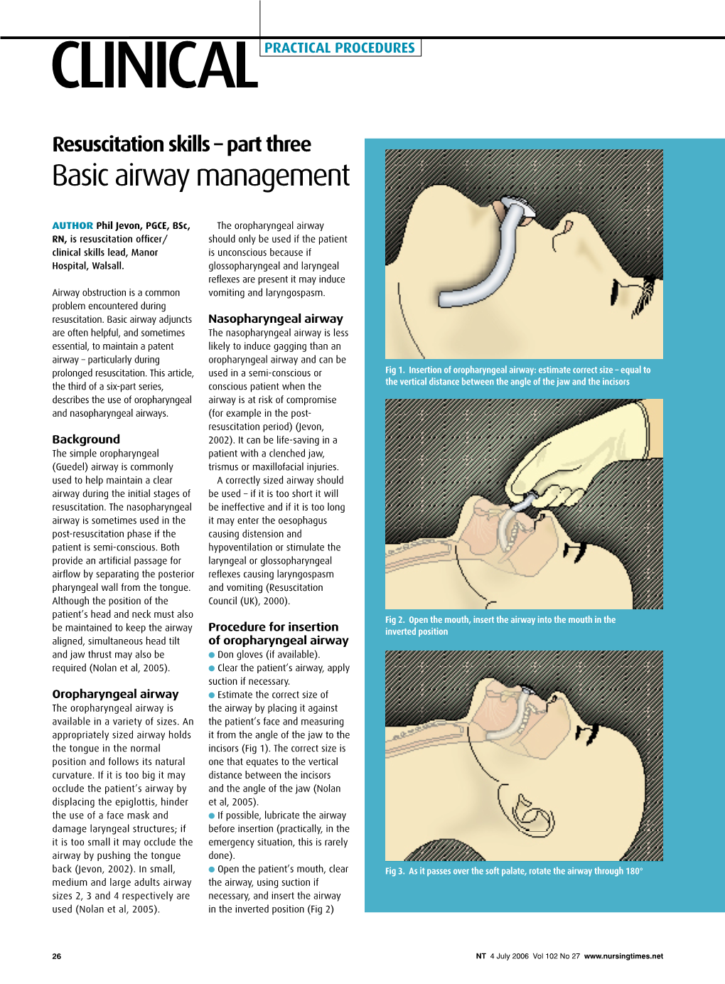 Resuscitation Skills – Part Three Basic Airway Management