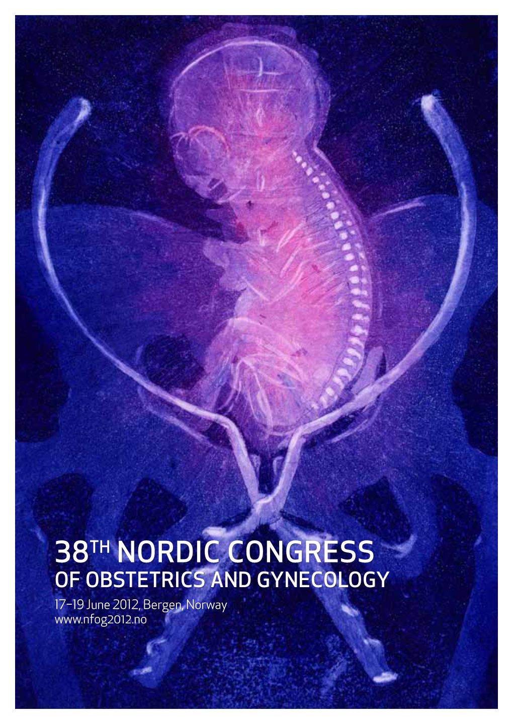 38Th Nordic Congress of Obstetrics and Gynecology 17–19 June 2012, Bergen, Norway Table of Contents: Organisation 3