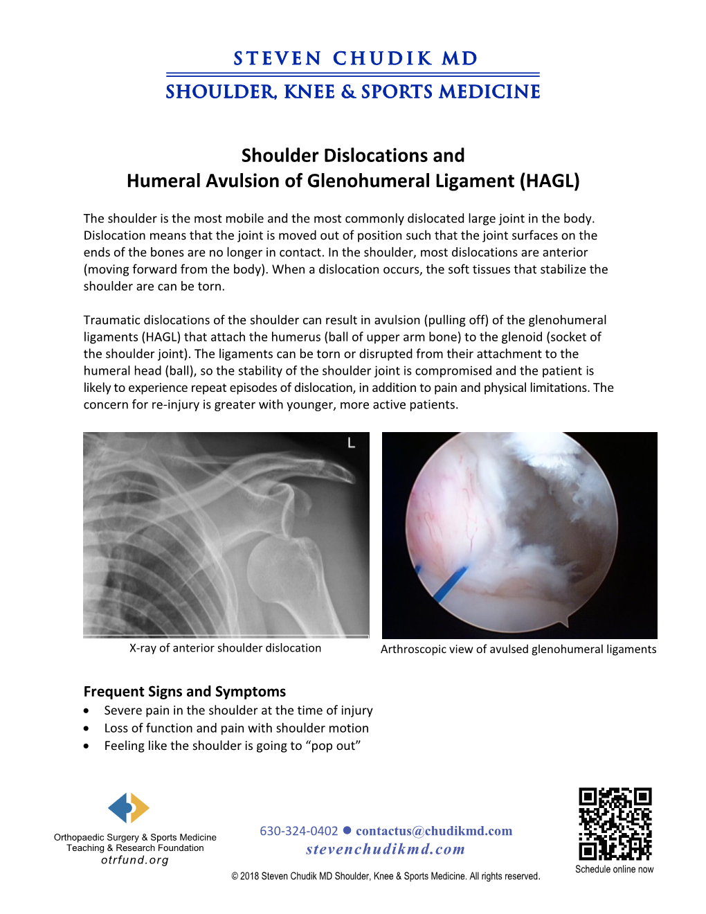 Shoulder Dislocations and Humeral Avulsion of Glenohumeral Ligament (HAGL)