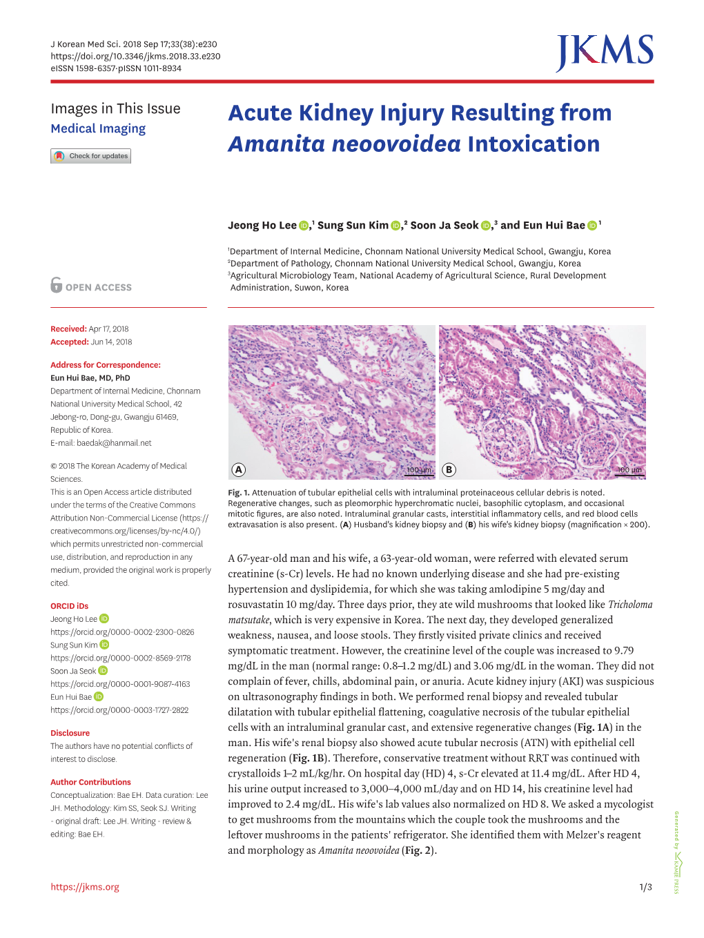 Acute Kidney Injury Resulting from Amanita Neoovoidea Intoxication