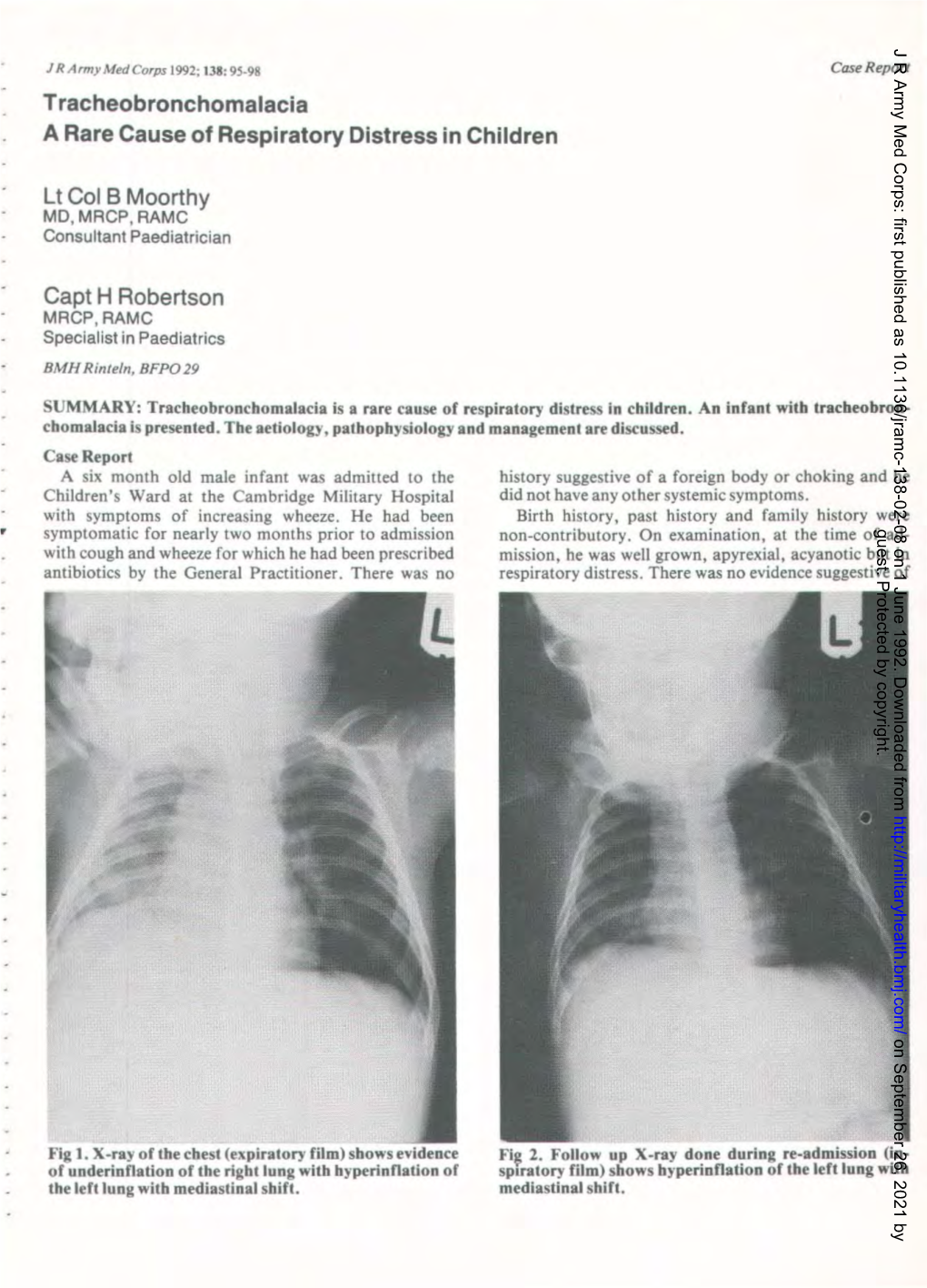 A Rare Cause of Respiratory Distress in Children