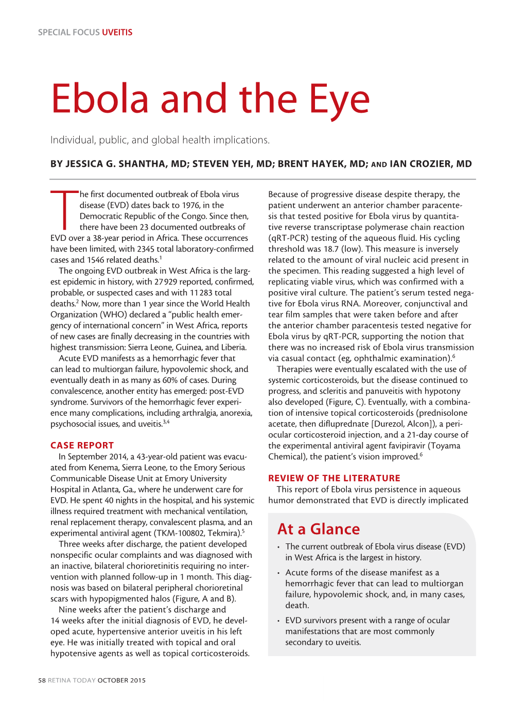 Ebola and the Eye