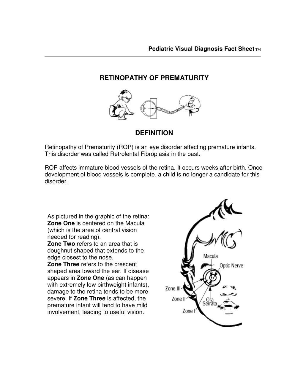 Retinopathy of Prematurity (ROP) Is an Eye Disorder Affecting Premature Infants