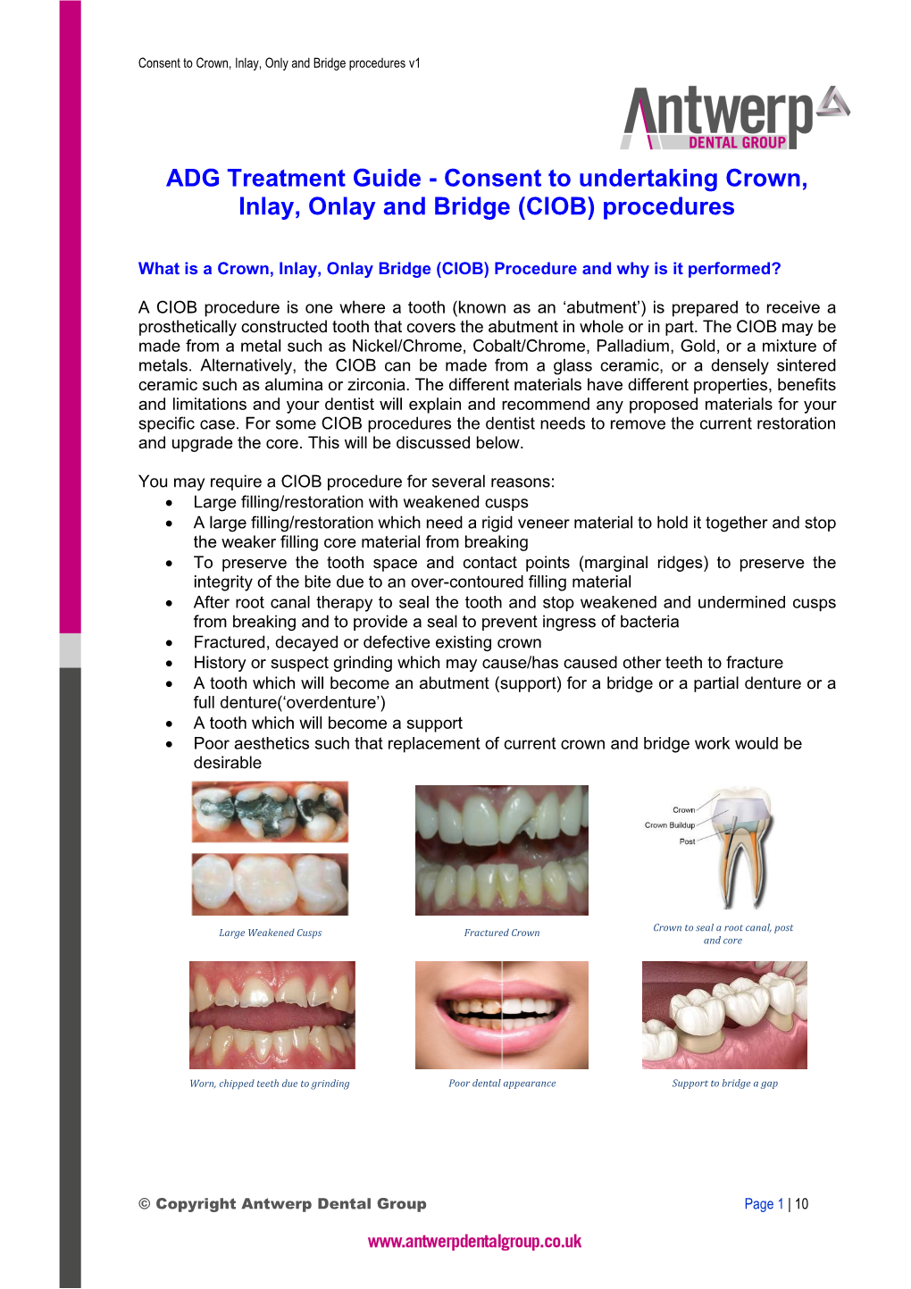 Consent to Undertaking Crown, Inlay, Onlay and Bridge (CIOB) Procedures