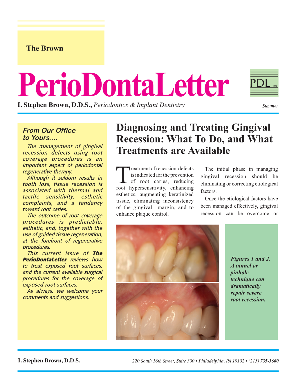 Diagnosing and Treating Gingival Recession
