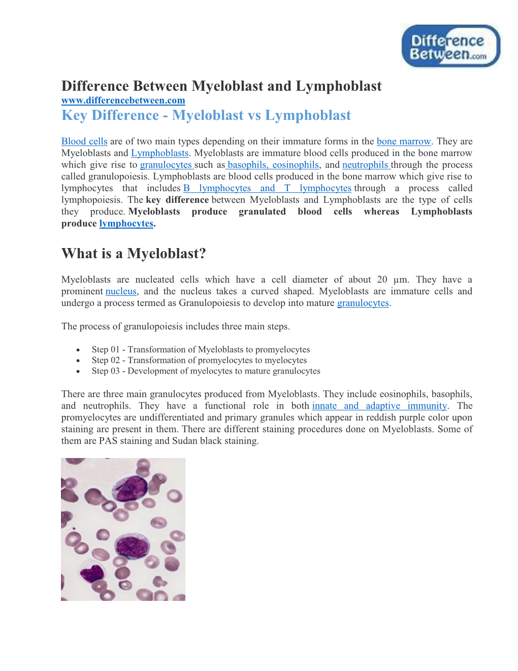 Difference Between Myeloblast and Lymphoblast Key Difference - Myeloblast Vs Lymphoblast