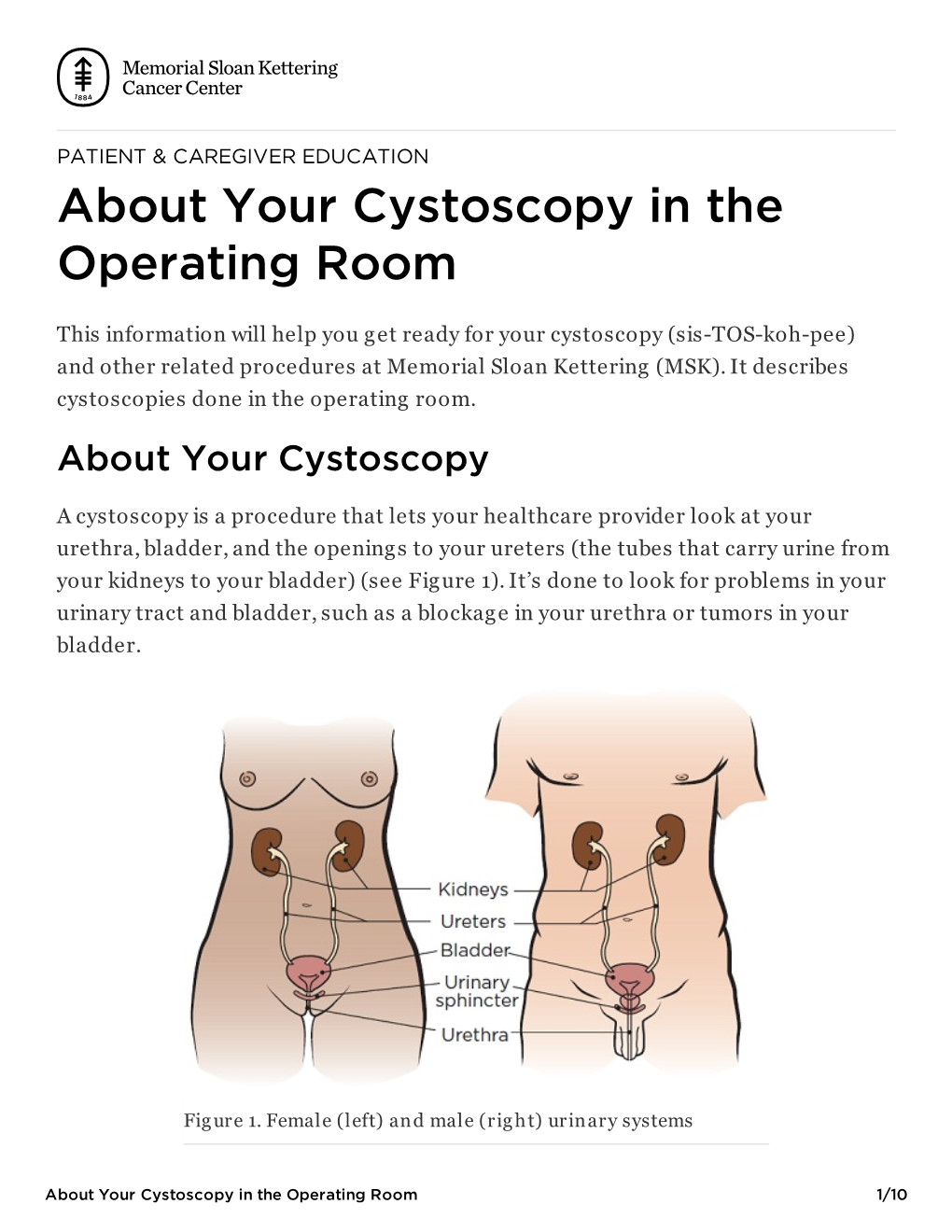 About Your Cystoscopy in the Operating Room | Memorial Sloan Kettering Cancer Center