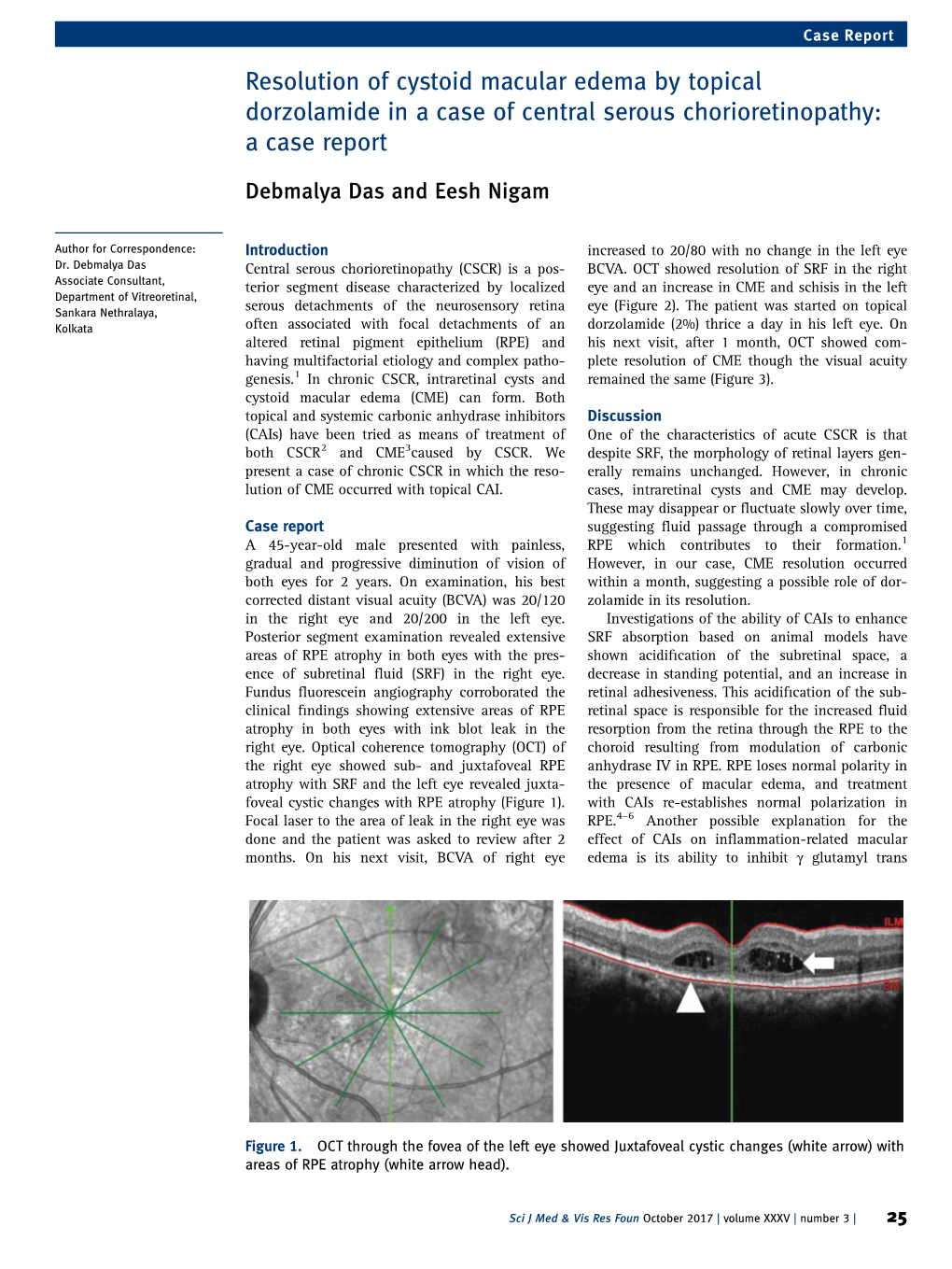 Resolution of Cystoid Macular Edema by Topical Dorzolamide in a Case of Central Serous Chorioretinopathy: a Case Report