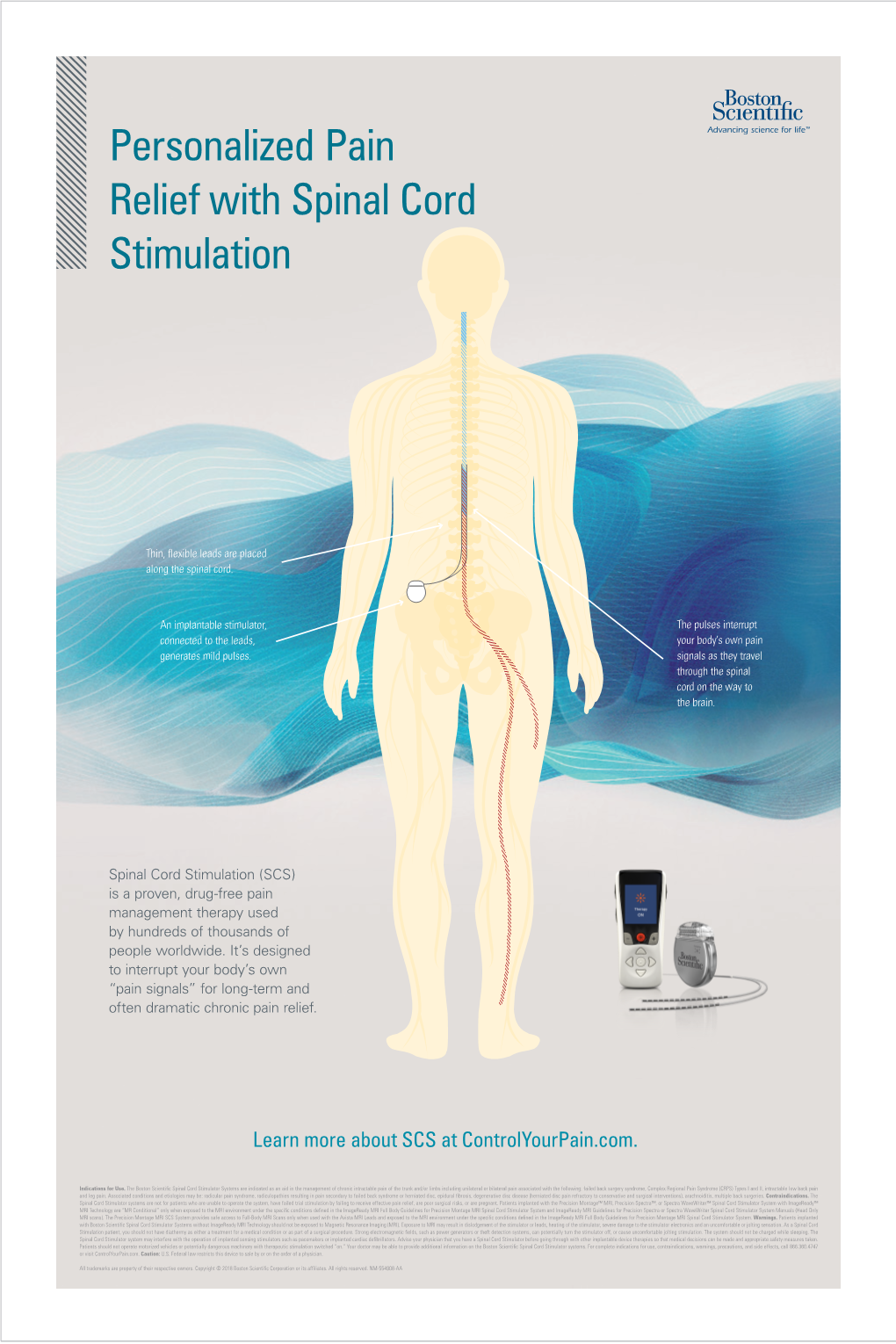 SCS As a Therapy Patient Poster