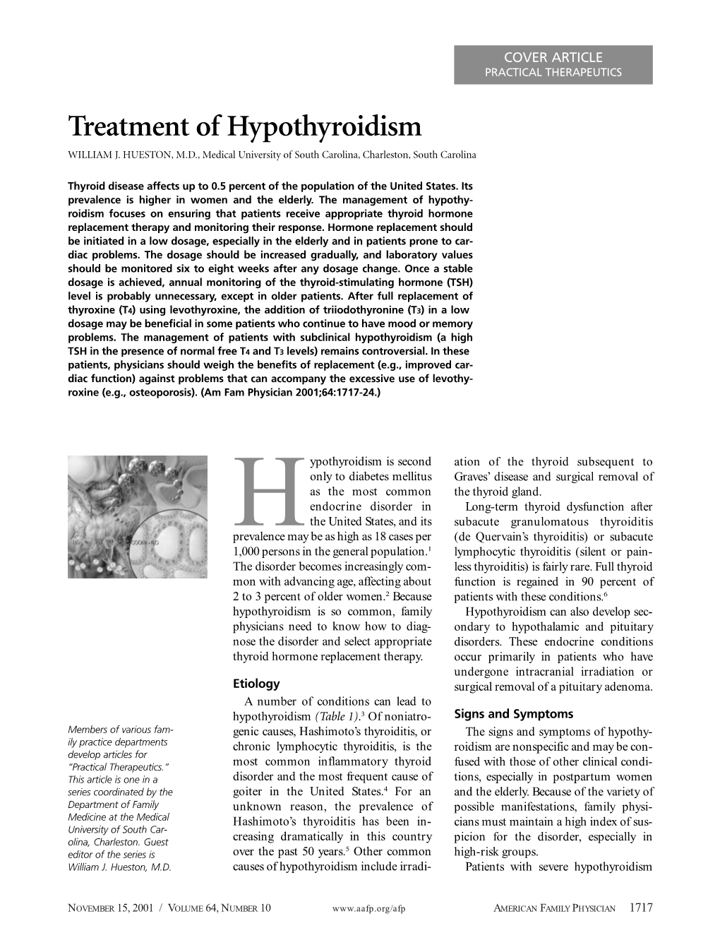 Treatment of Hypothyroidism WILLIAM J